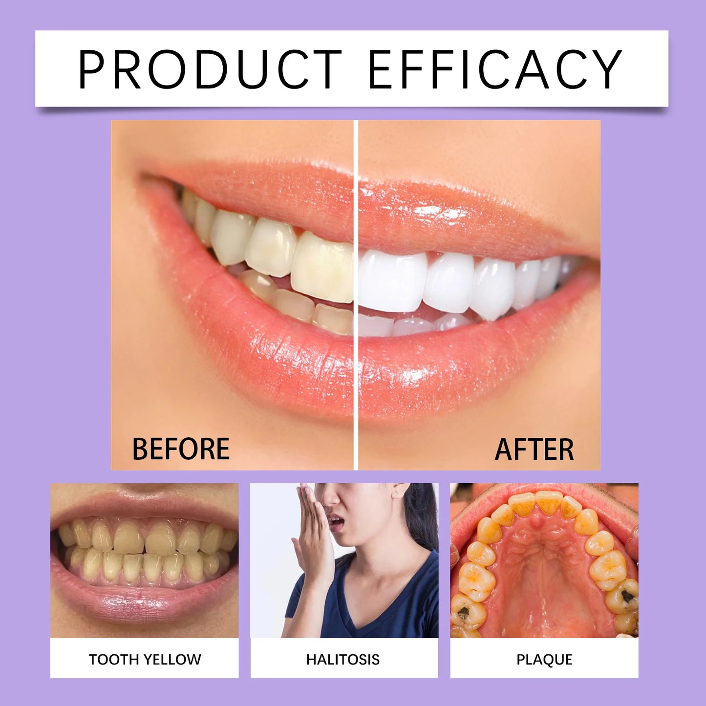 Teeth Whitening Gel - Instant White Touch-Up