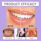 Teeth Whitening Gel - Instant White Touch-Up